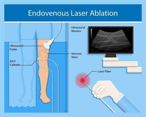 EVLT - El Paso, TX: Imaging & Interventional Specialists