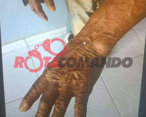 Lesão Corporal Contra Idoso - POLÍCIA MILITAR ATENDE DUAS OCORRÊNCIAS DE LESÃO CORPORAL, ENVOLVENDO ...