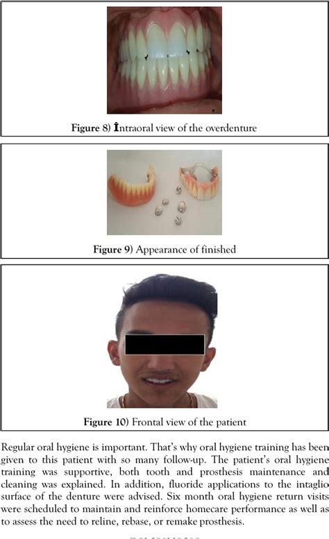 Figure 1 from Prosthetic Treatment of a Patient with Non-syndromic Oligodontia | Semantic Scholar