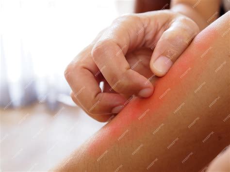 premium photo people  skin problems  scratching  itching