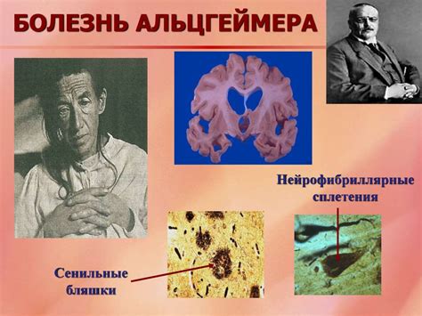 Когнитивные нарушения при неврологических заболеваниях - online ...