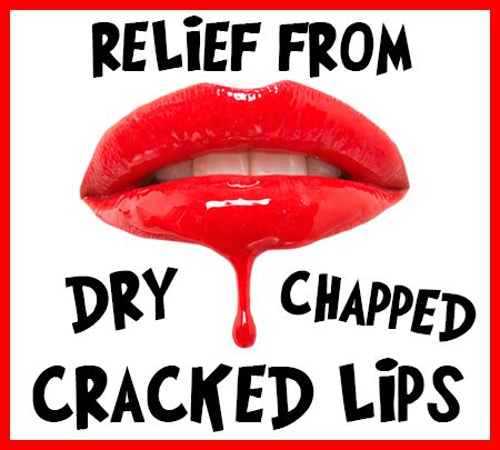 Cracked Lips in Edmonds - Dr. Matthew Flugstad - Dayton Dental