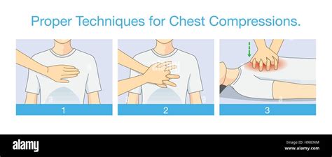 proper techniques  chest compression stock vector image art alamy