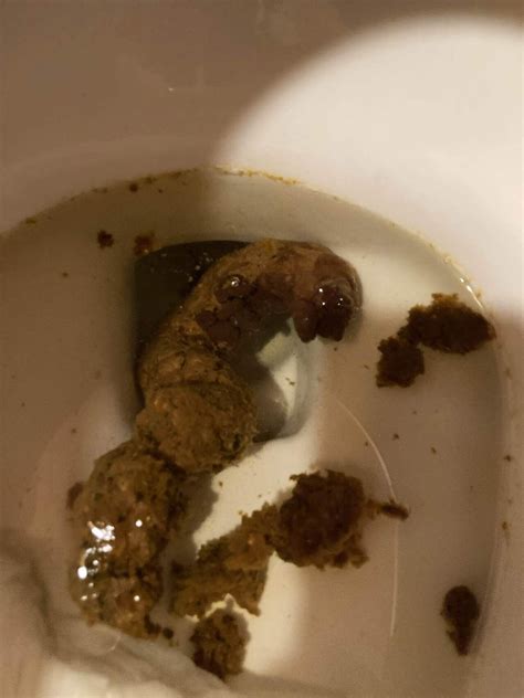 俺のうんこ💩#17｜もめん