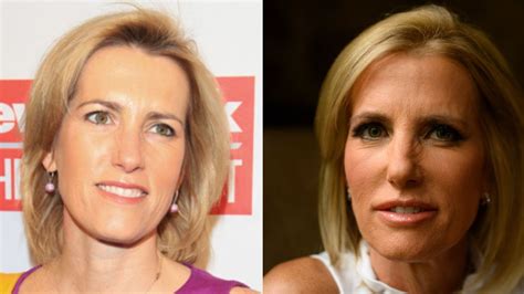 Laura Ingraham’s Plastic Surgery: Botox, Facelift, and Lip Augmentation!