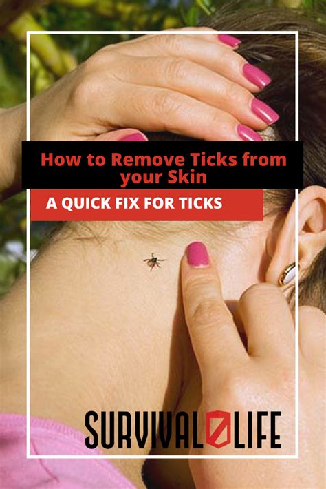 The Tick Trap: 5 Ways To Safely Remove Ticks From Hair