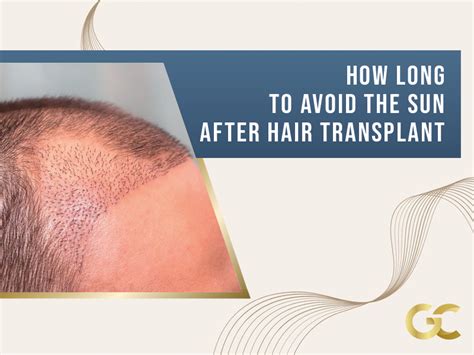 how long to avoid sun after hair transplant