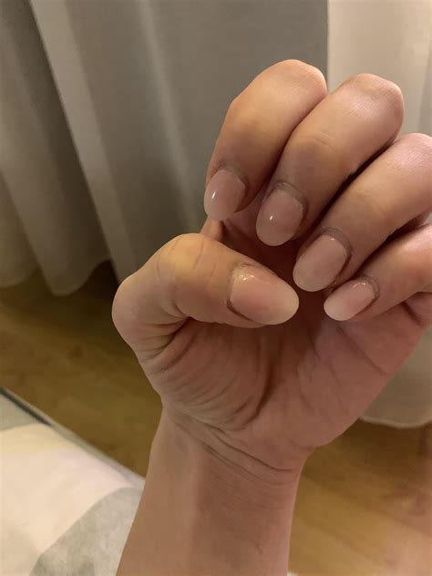 Why do my nails fold down like this?! Happens on these two fingers and