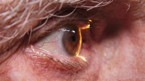 Close-up of a senior man having his vision tested on an ophthalmology