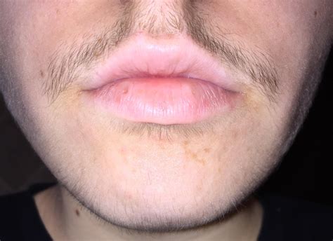 months   wishing  chin hairs   noticeable