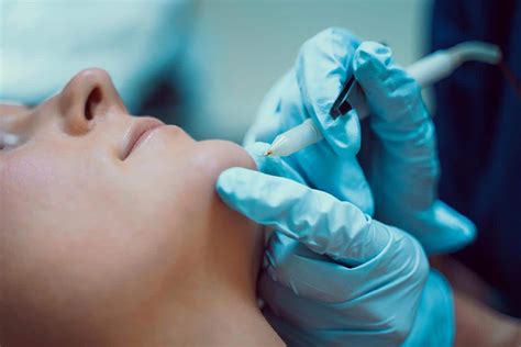 ELECTROLYSIS - My WordPress