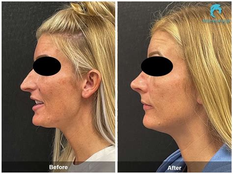 Murrieta Patch: Before & After Photos Will Astound You! Image 2
