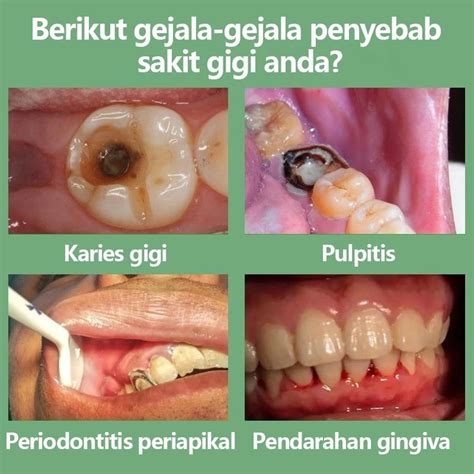 jual obat sakit gigi berlubang ampuh semprotan pereda nyeri sakit gigi