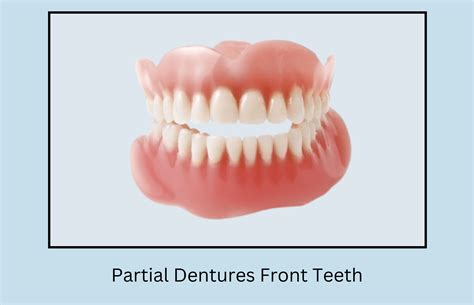 Partial Dentures Front Teeth Before and After Photos - Oral Health Line