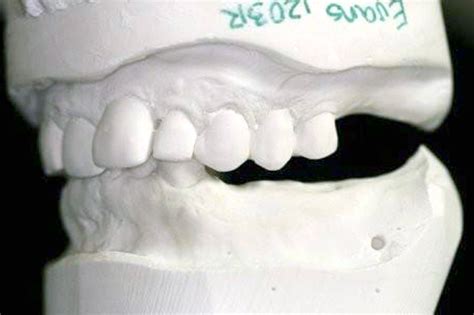 BRUXER – Team Root