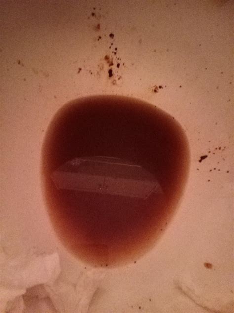 Diarrhea - Ate Too Much Ice Cream : r/poop