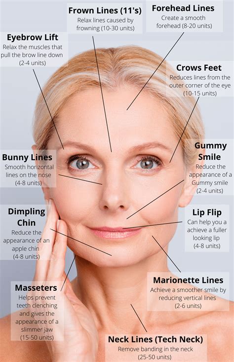 Nurse injector cosmetic nurse botox anatomy cosmetic nurse tips