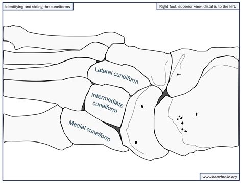 Merely a cuneiformality: Identifying and siding the cuneiforms | Bone Broke