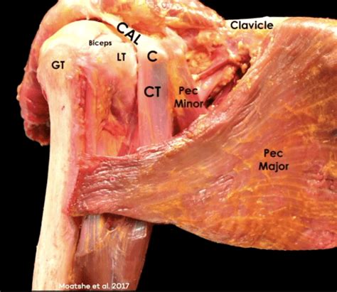 What can you find in the short axis view of the biceps tendon on the ...