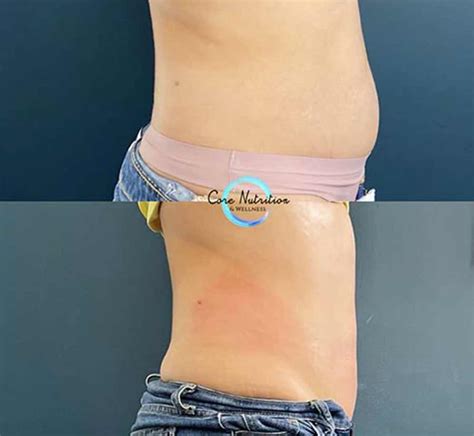 Before and After Photos of Clients in Northridge, CA