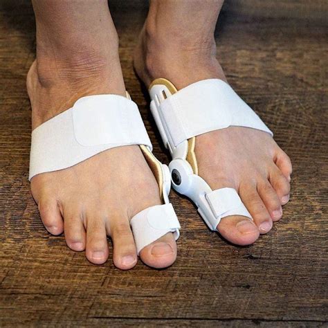 Orthopedic Bunion Splint Toe Corrector (2 Pcs) - Valgus pro bunion ...