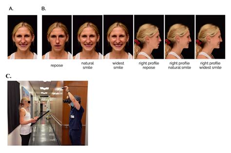 Video: A Standardized Approach to Extra-Oral and Intra-Oral Digital
