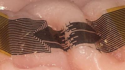 revolutionising brain monitoring  stimulation  thin film neural