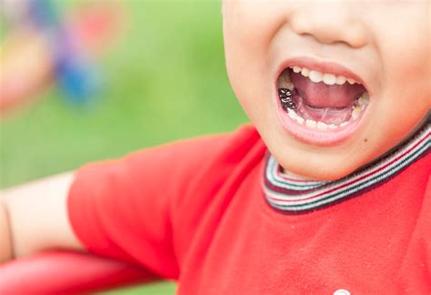 Dientes en forma de sierra: ¿es normal? - Eres Mamá