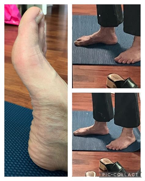 122 best r/footfunction images on Pholder | Is it possible to bring my