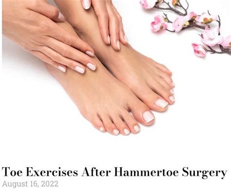 Toe exercises after Hammertoe Surgery | Hammer toe surgery, Hammer toe ...