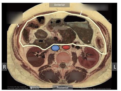 Week 3 - Peritoneal Spaces Diagram | Quizlet