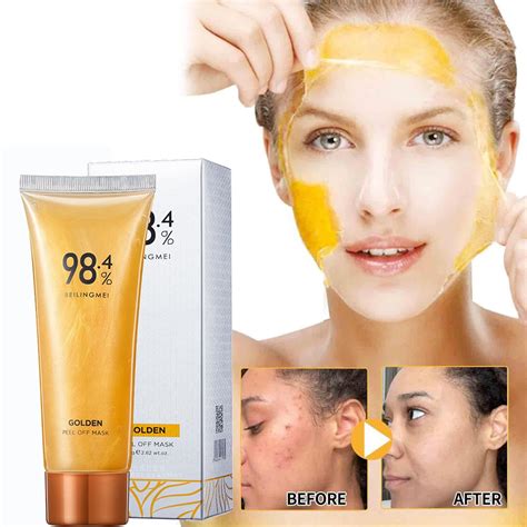 Top 10 Unbelievable Blackhead Removal 2024 Products You NEED To Try In 2024! Image 9