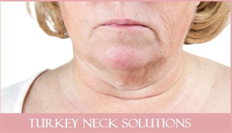 Turkey Neck Solutions