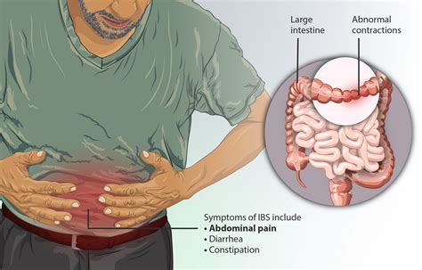 Healing Irritable Bowel Syndrome (IBS): A Root Cause Approach - Hormone