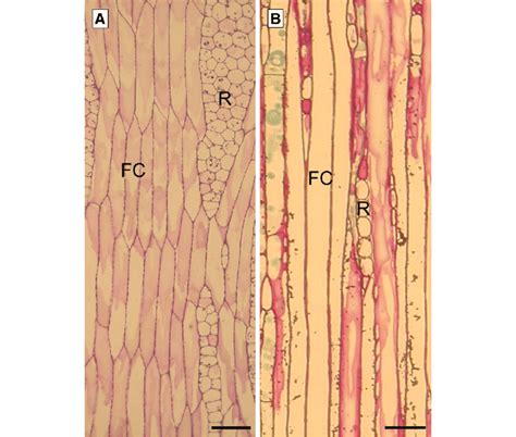 Tangential sections of storeyed (Tilia cordata) and nonstoreyed (Pinus ...
