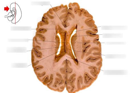 transverse cut  brain   diagram quizlet