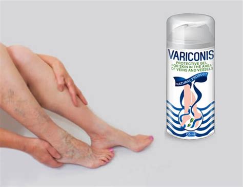 Variconis крем Ефект и Резултати - Върши ли работа?