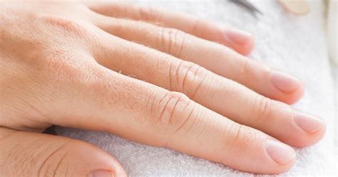 What is nail clubbing? Curved fingernails can signal lung cancer