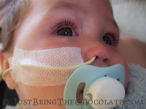 What To Do If Ng Tube Comes Out at Clifford Ward blog