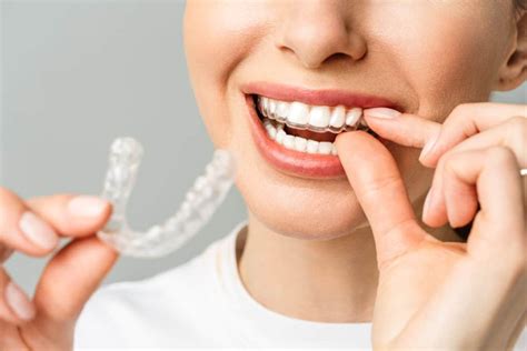 invisible braces explained    benefits