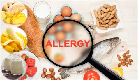 how to treat allergies at home