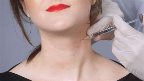 Surgical Treatments of Wrinkles and Creases on the Neck