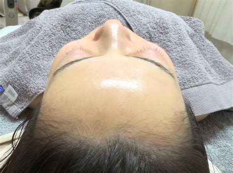 wiqofacialwax atsolvebeauty