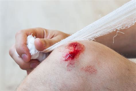 effektive behandlung offener wunden