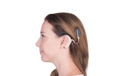 Am I a Cochlear Implant Candidate? - Flagstaff Business News