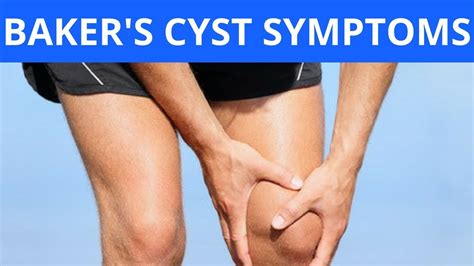 Baker's Cyst Symptoms - YouTube