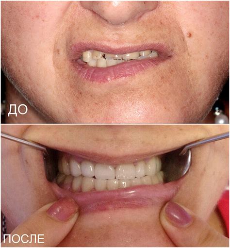 Стоматологія Краматорськ ᐉ Стоматологічна клініка | Dental Tech