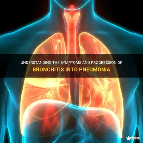understanding  symptoms  progression  bronchitis  pneumonia