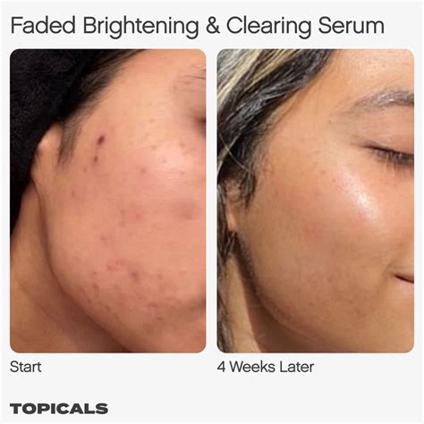 Topicals Faded Serum For Dark Spots & Discoloration 15ml - Beautynation ...