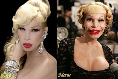 Amanda Lepore Botched Plastic Surgery Story - #Amanda #Botched #Lepore ...